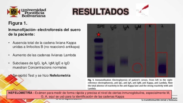 cadenas livianas kappa en suero immunoglobulin k light chain deficiency a rare but cadenas livianas kappa en suero immunoglobulin k light chain deficiency a rare but
