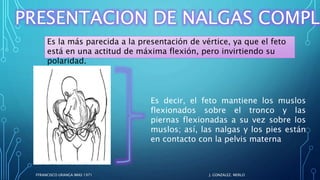 FFRANCISCO URANGA IMAS 1971
PRESENTACION DE NALGAS COMPLE
Es la más parecida a la presentación de vértice, ya que el feto
está en una actitud de máxima flexión, pero invirtiendo su
polaridad.
J. GONZALEZ. MERLO
Es decir, el feto mantiene los muslos
flexionados sobre el tronco y las
piernas flexionadas a su vez sobre los
muslos; así, las nalgas y los pies están
en contacto con la pelvis materna
 