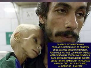 DEBEMOS ESTREMECERNOS                                   POR LAS INJUSTICAS QUE SE COMETEN                   EN EL SALVAJE MUNDO CAPITALISTA.                                               POR LO QUE HAY QUE LUCHAR SIN TREGUA, OFRECIENDO UNA EDUCACION CIENTIFICA, PARA QUE NUESTROS HIJOS NO SUFRAN DESNUTRICION, INANICION Y PATOLOGIAS GRAVES COMO LAS DE ESTE NIÑO,                             AL BORDE DE LA MUERTE