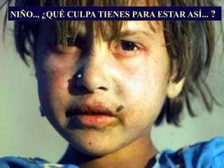 NIÑO.., ¿QUÉ CULPA TIENES PARA ESTAR ASÍ... ?
