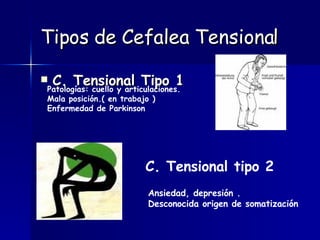 Tipos de Cefalea Tensional C. Tensional Tipo 1 Patologías: cuello y articulaciones. Mala posición.( en trabajo )  Enfermedad de Parkinson C. Tensional tipo 2 Ansiedad, depresión . Desconocida origen de somatización   