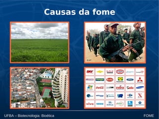 UFBA – Biotecnologia: Bioética FOME
Causas da fome
 