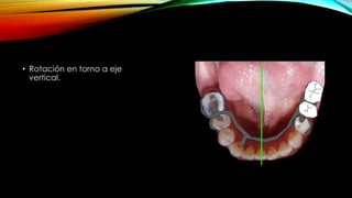 • Rotación en torno a eje
vertical.
 