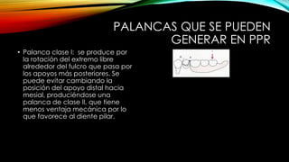 PALANCAS QUE SE PUEDEN
GENERAR EN PPR
• Palanca clase I: se produce por
la rotación del extremo libre
alrededor del fulcro que pasa por
los apoyos más posteriores. Se
puede evitar cambiando la
posición del apoyo distal hacia
mesial, produciéndose una
palanca de clase II, que tiene
menos ventaja mecánica por lo
que favorece al diente pilar.
 