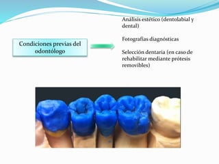 Condiciones previas del
odontólogo
Análisis estético (dentolabial y
dental)
Fotografías diagnósticas
Selección dentaria (en caso de
rehabilitar mediante prótesis
removibles)
 