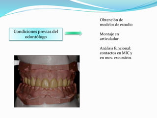 Condiciones previas del
odontólogo
Obtención de
modelos de estudio
Montaje en
articulador
Análisis funcional:
contactos en MIC y
en mov. excursivos
 