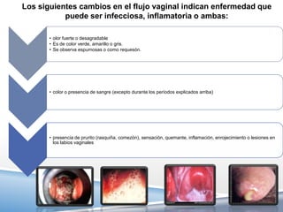 Los siguientes cambios en el flujo vaginal indican enfermedad que
           puede ser infecciosa, inflamatoria o ambas:

       • olor fuerte o desagradable
       • Es de color verde, amarillo o gris.
       • Se observa espumosas o como requesón.




       • color o presencia de sangre (excepto durante los períodos explicados arriba)




       • presencia de prurito (rasquiña, comezón), sensación, quemante, inflamación, enrojecimiento o lesiones en
         los labios vaginales
 