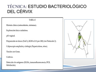 TÉCNICA: ESTUDIO BACTERIOLÓGICO
DEL CÉRVIX
 