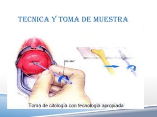 TECNICA Y TOMA DE MUESTRA
 