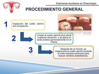 Exámenes Auxiliares en Ginecología

            PROCEDIMIENTO GENERAL


Inspección del cuello uterino
con el espéculo



                      Limpiar el cuello uterino para retirar
                       cualquier secreción, y se aplica el
                      ácido acético generosamente en el
                                    mismo.


                                                 Después de un minuto, se
                                          inspecciona el cuello uterino (incluida
                                             la unión escamo-columnar) para
                                              buscar cambios acetoblancos.
 