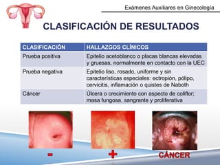 Exámenes Auxiliares en Ginecología


         CLASIFICACIÓN DE RESULTADOS

CLASIFICACIÓN     HALLAZGOS CLÍNICOS
Prueba positiva   Epitelio acetoblanco o placas blancas elevadas
                  y gruesas, normalmente en contacto con la UEC
Prueba negativa   Epitelio liso, rosado, uniforme y sin
                  características especiales: ectropión, pólipo,
                  cervicitis, inflamación o quistes de Naboth
Cáncer            Úlcera o crecimiento con aspecto de coliflor;
                  masa fungosa, sangrante y proliferativa
 