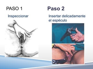 PASO 1
Inspeccionar   Insertar delicadamente
               el espéculo
 