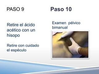 PASO 9

                     Examen pélvico
Retire el ácido
                     bimanual
acético con un
hisopo

Retire con cuidado
el espéculo
 