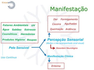 Produtos Higiene
UVFatores Ambientais
Cosméticos
SabõesÁgua Estresse
Hormônios
Roupas
Manifestação
Pele Sensível
(Muitas x não acompanhado sinal visual)
Percepção Sensorial
Manifestação Clínica
Eritema
Agulhadas
Queimação Ardência
Coceira
Dor Formigamento
Desordem Neurológica
Uso Contínuo
 