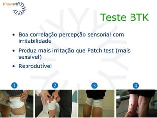 Teste BTK
• Boa correlação percepção sensorial com
irritabilidade
• Produz mais irritação que Patch test (mais
sensível)
• Reprodutível
❶ ❷ ❸ ❹
 
