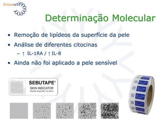 Determinação Molecular
• Remoção de lipídeos da superfície da pele
• Análise de diferentes citocinas
– ↑ IL-1RA / ↑ IL-8
• Ainda não foi aplicado a pele sensível
 