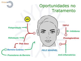 Oportunidades no
Tratamento
PELE SENSÍVEL
+
UV
Pele Seca
Fotoproteção
Hidratação
Barreira Cutânea
Promotores de Barreira
+
+
Anti-inflamatórios
Prostaglandinas
TRPV1
+
Inibidores
 