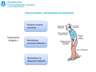 CÉLULAS MADRE Y ENFERMEDAD DE PARKINSON
Tratamiento
dirigido a
Prevenir muerte
neuronal.
Reemplazar
neuronas faltantes.
Reemplazar la
dopamina faltante.
 
