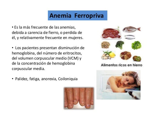 Anemia Seminario10