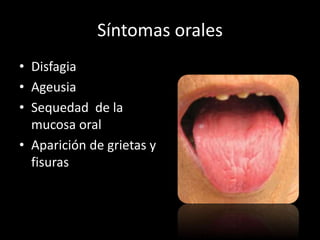 Síntomas orales
• Disfagia
• Ageusia
• Sequedad de la
mucosa oral
• Aparición de grietas y
fisuras
 