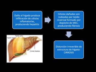 Daño al hígado produce
infiltración de células
inflamatorias,
produciendo hepatitis
Células dañadas son
rodeadas por tejido
cicatrizal formado por
depósito de MEC,
produciendo fibrosis
Distorsión irreverible de
estructura de hígado:
CIRROSIS
 
