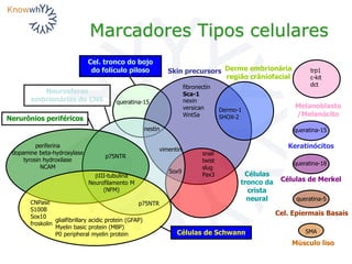 Marcadores Tipos celulares
fibronectin
Sca-1
nexin
versican
Wnt5a
Skin precursors
vimentin
Neurosferas
embrionárias do CNS
Dermo-1
SHOX-2
Sox9
Células
tronco da
crista
neural
p75NTR snail
twist
slug
Pax3
periferina
dopamine beta-hydroxylase
tyrosin hydroxilase
NCAM
bIII-tubulina
Neurofilamento M
(NFM)
CNPase
S100B
Sox10
froskolin
p75NTR
glialfibrillary acidic protein (GFAP)
Myelin basic protein (MBP)
P0 peripheral myelin protein Células de Schwann
Nerurônios periféricos
queratina-18
queratina-15
queratina-5
Derme embrionária
região crâniofacial
SMA
Células de Merkel
Cel. tronco do bojo
do folículo piloso
Cel. Epiermais Basais
Músculo liso
trp1
c-kit
dct
Melanoblasto
/Melanócito
nestin queratina-15
Keratinócitos
 