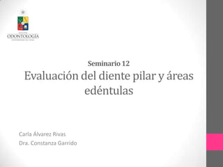 Seminario12
Evaluación del diente pilar y áreas
edéntulas
Carla Álvarez Rivas
Dra. Constanza Garrido
 