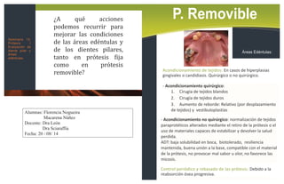 baja solubilidad en boca, es biotolerado, presenta una suavidad y resiliencia mantenida, buena unión a la base, compatible...