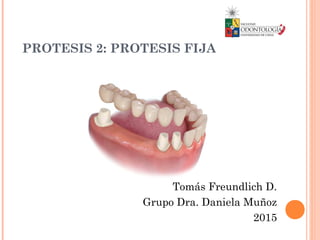 PROTESIS 2: PROTESIS FIJA
Tomás Freundlich D.
Grupo Dra. Daniela Muñoz
2015
 