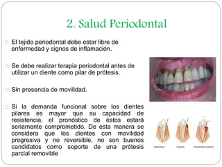 2. Salud Periodontal 
El tejido periodontal debe estar libre de 
enfermedad y signos de inflamación. 
Se debe realizar ter...