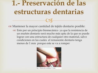 
 Mantener la mayor cantidad de tejido dentario posible:
 Esto por un principio biomecánico ya que la resistencia de
un muñón dentario será mucho más apta de la que se puede
lograr con una estructura de cualquier otro material, salvo
condiciones en las cuales el remanente dentario tenga
menos de 1 mm porque este se va a romper
1.- Preservación de las
estructuras dentarias
 