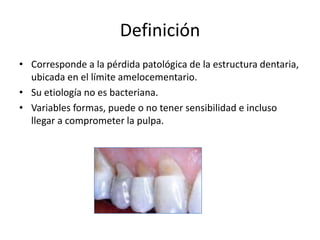 Definición
• Corresponde a la pérdida patológica de la estructura dentaria,
ubicada en el límite amelocementario.
• Su etiología no es bacteriana.
• Variables formas, puede o no tener sensibilidad e incluso
llegar a comprometer la pulpa.
 