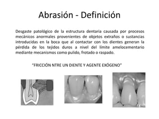 Abrasión - Definición
Desgaste patológico de la estructura dentaria causada por procesos
mecánicos anormales provenientes de objetos extraños o sustancias
introducidas en la boca que al contactar con los dientes generan la
pérdida de los tejidos duros a nivel del límite amelocementario
mediante mecanismos como pulido, frotado o raspado.
“FRICCIÓN NTRE UN DIENTE Y AGENTE EXÓGENO”
 