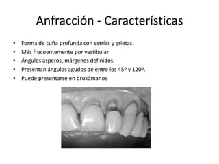 Anfracción - Características
• Forma de cuña profunda con estrías y grietas.
• Más frecuentemente por vestibular.
• Ángulos ásperos, márgenes definidos.
• Presentan ángulos agudos de entre los 45º y 120º.
• Puede presentarse en bruxómanos
 