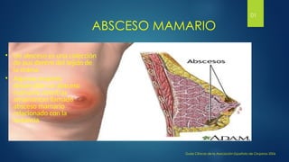 ABSCESO MAMARIO
• Un absceso es una colección
de pus dentro del tejido de
la mama.
• Algunas mujeres
desarrollan un absceso
mamario mientras
amamantan llamado
absceso mamario
relacionado con la
lactancia
Guías Clínicas de la Asociación Española de Cirujanos 2006
01
 
