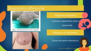 Cáncer de mama inflamatorio
Diagnóstico diferencial
Mujeres lactantes
Mujeres no lactantes
• Conductos galactóforos obstruidos
• Galactocele
Guías Clínicas de la Asociación Española de Cirujanos 2006
 