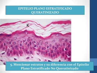 EPITELIO PLANO ESTRATIFICADO
QUERATINIZADO
5. Mencionar estratos y su diferencia con el Epitelio
Plano Estratificado No Queratinizado
 