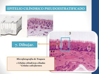 EPITELIO CILÍNDRICO PSEUDOESTRATIFICADO
7. Dibujar.
 