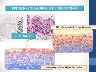 EPITELIO POLIMORFO O DE TRANSICIÓN
9. Dibujar.
 