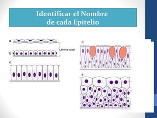 Identificar el Nombre
de cada Epitelio
 