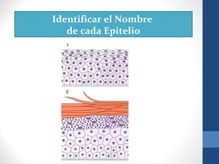 Identificar el Nombre
de cada Epitelio
 