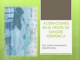 ALTERACIONES
EN EL FROTIS DE
SANGRE
PERIFERICA
Dra. Cristina Peñaherrera
HEMATOLOGA
 