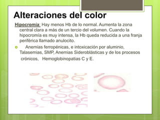 Alteraciones del color
Hipocromía: Hay menos Hb de lo normal. Aumenta la zona
central clara a más de un tercio del volumen. Cuando la
hipocromía es muy intensa, la Hb queda reducida a una franja
periférica llamado anulocito.
 Anemias ferropénicas, e intoxicación por aluminio,
Talasemias, SMP, Anemias Sideroblásticas y de los procesos
crónicos, Hemoglobinopatias C y E.
 