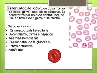 Estomatocito: Célula en boca, forma
de copa, gorro, seta, disco cóncavo. Se
caracteriza por un área central libre de
Hb, en forma de cigarro o salchicha
Se observan en:
 Estomatocitosis hereditaria
 Alcoholismo, Cirrosis hepática
 Anemias hemolíticas
 Enzimopatía de la glucolísis
 Ictero obtructivo
 Artefactos
 