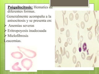 Poiquilocitosis: Hematíes de
diferentes formas.
Generalmente acompaña a la
anisocitosis y se presenta en:
 Anemias severas
 Eritropoyesis inadecuada
 Mielofibrosis
Leucemias.
 