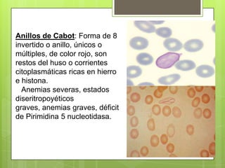 Anillos de Cabot: Forma de 8
invertido o anillo, únicos o
múltiples, de color rojo, son
restos del huso o corrientes
citoplasmáticas ricas en hierro
e histona.
Anemias severas, estados
diseritropoyéticos
graves, anemias graves, déficit
de Pirimidina 5 nucleotidasa.
 