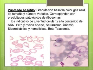 Punteado basófilo: Granulación basófila color gris azul,
de tamaño y número variable. Corresponden con
precipitados patológicos de ribosomas.
Es indicativo de juventud celular y alto contenido de
ARN. Feto y recién nacido, Saturnismo, Anemia
Sideroblástica y hemolíticas, Beta Talasemia.
 
