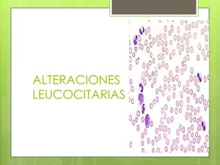 ALTERACIONES
LEUCOCITARIAS
 