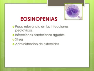 EOSINOPENIAS
 Poca relevancia en las infecciones
pediátricas.
 Infecciones bacterianas agudas.
 Stress
 Administración de esteroides
 