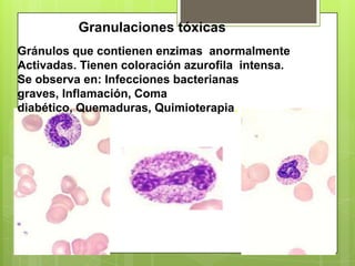 Granulaciones tóxicas
Gránulos que contienen enzimas anormalmente
Activadas. Tienen coloración azurofila intensa.
Se observa en: Infecciones bacterianas
graves, Inflamación, Coma
diabético, Quemaduras, Quimioterapia.
 